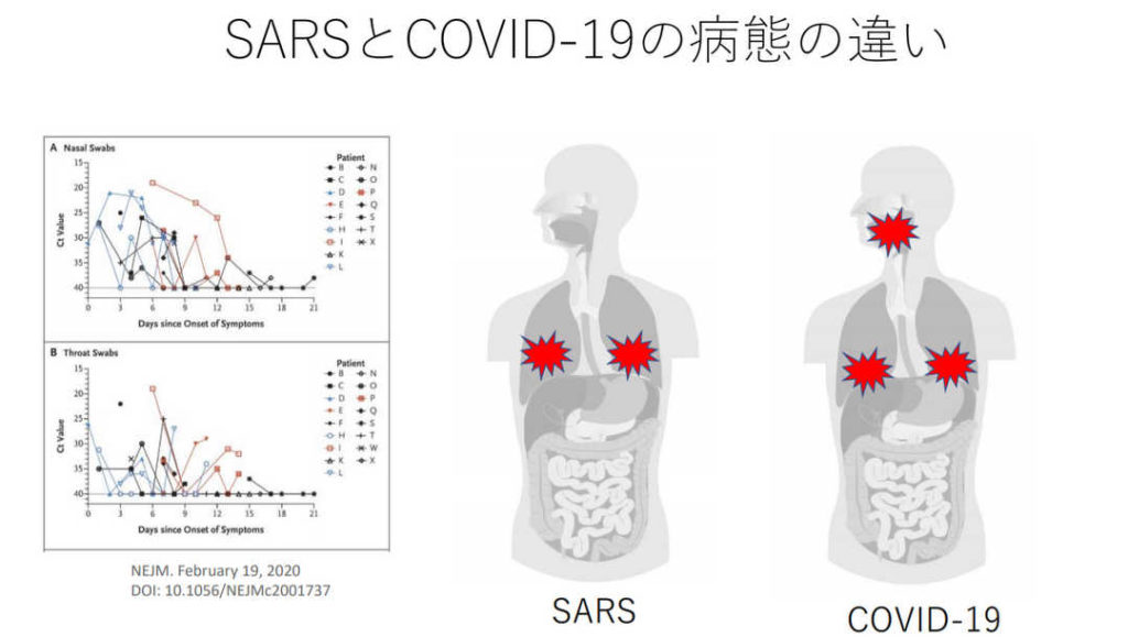 新コロナとSARS・インフルエンザとの違いと、日本の現状